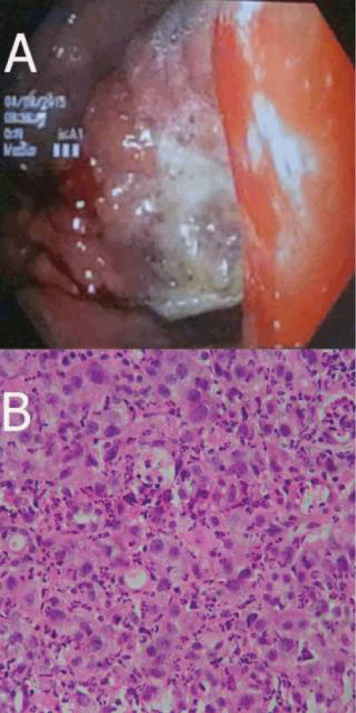 Endoscopia
