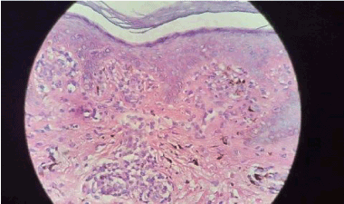 basal