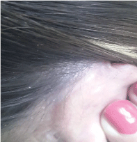derecho