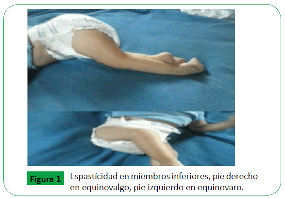 Que es unilateral en medicina