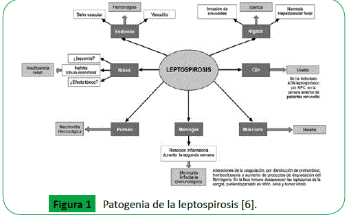 leptospirosis en humanos prevención de diabetes